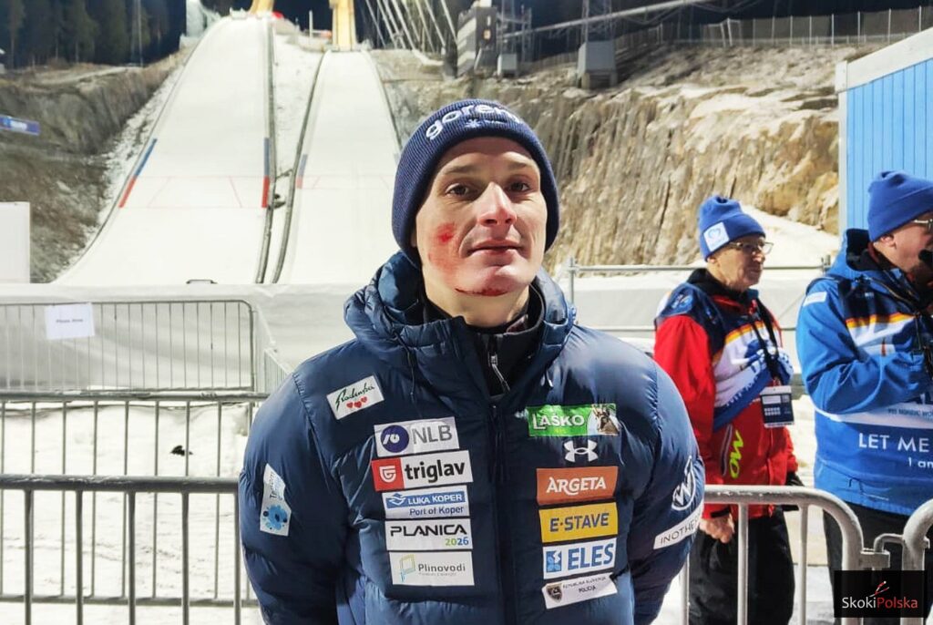 Read more about the article Domen Prevc z kolejnym podium w tym sezonie i… raną na twarzy. „Taki jest sport”